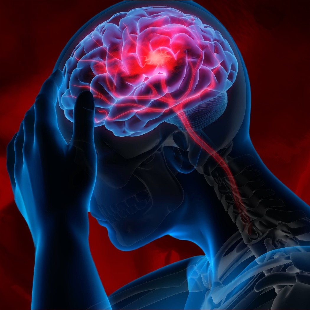 정맥주사의 약물 전달 속도